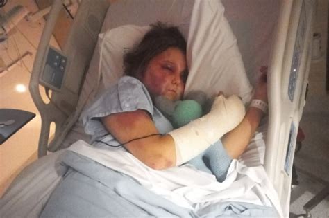 kirra hart|Teen victim of brutal alleged bashing speaks out about horrific